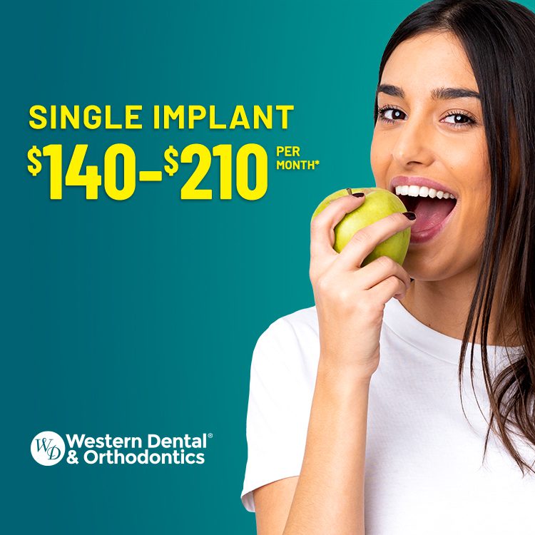 Single implant $140-210 per month*
