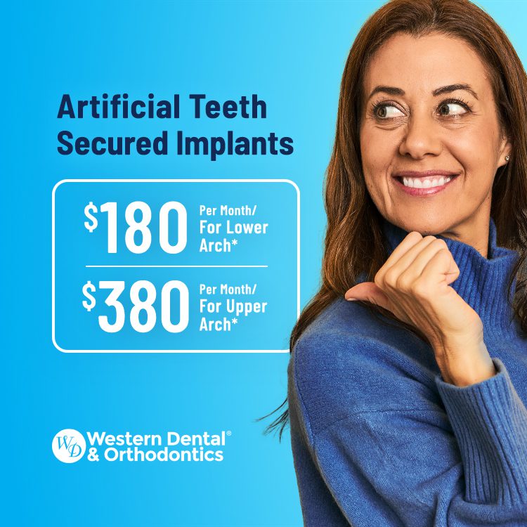 $180 per month for lower arch ($7,910 retail price)*  $380 per month for upper arch ($9,040 retail price)*